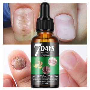 Nail Fungus